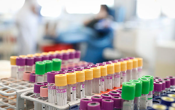 El Centro de Transfusión de Madrid necesita sangre para alcanzar las 5.000 donaciones esta semana