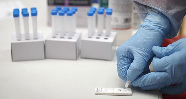 El jueves 21 de enero comenzarán a realizarse test de antígenos en Torrelodones